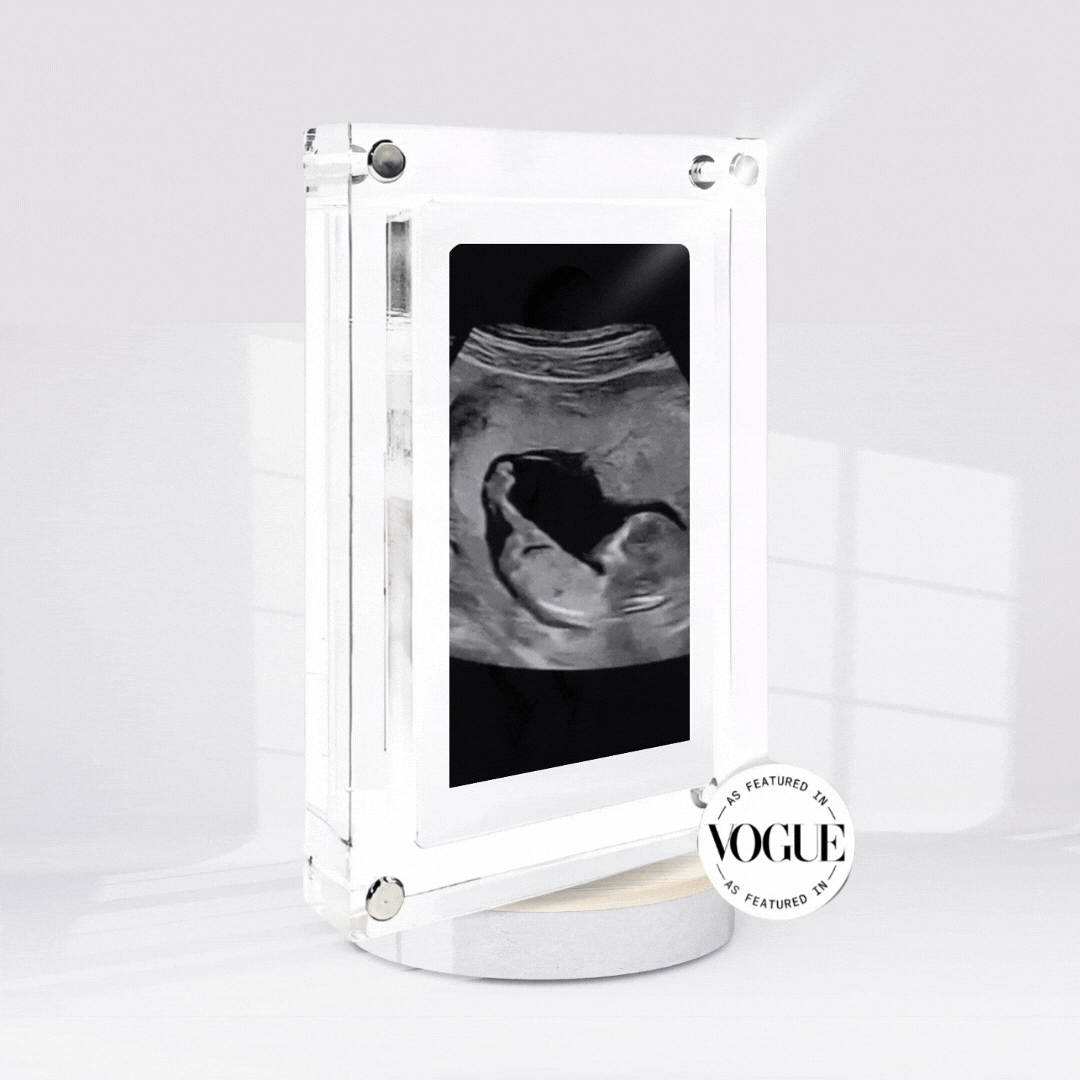 SoulSnap Live UltraSound Frame™